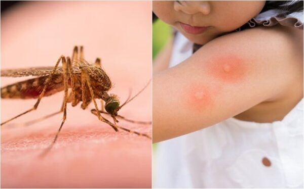 Vắc xin Jevax phòng Viêm não Nhật bản 