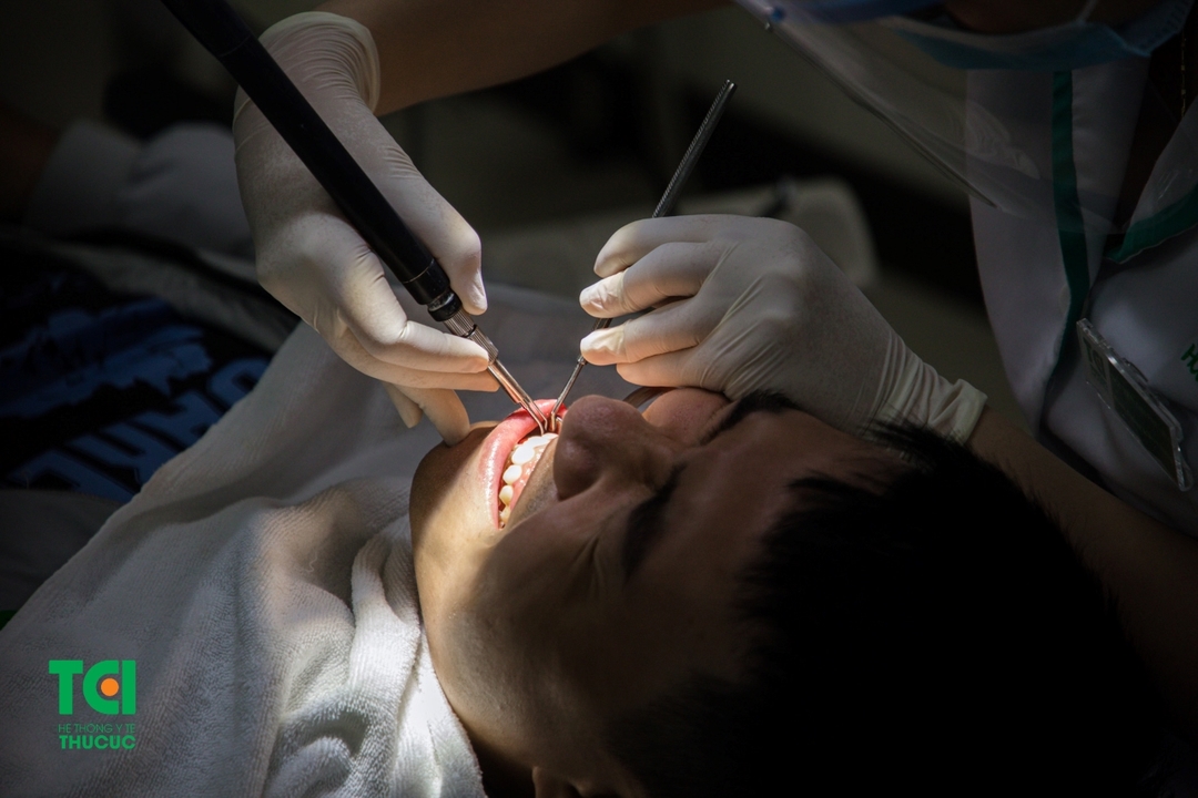 Trám răng Fuji và những ưu, nhược điểm