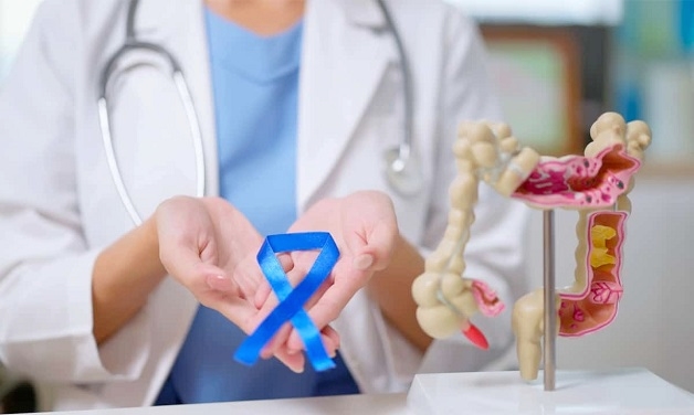 Viêm đại tràng mạn bệnh học là gì?