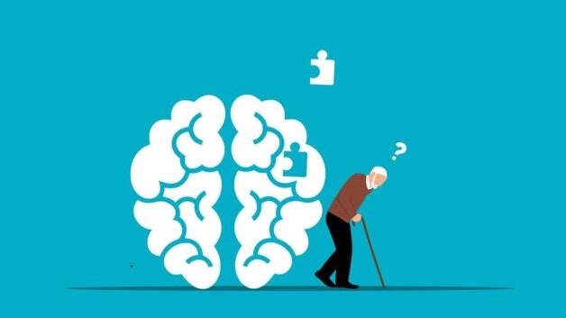 Hội chứng Alzheimer vẫn là ẩn số với các nhà khoa học, chưa thể tìm ra nguyên nhân chính xác