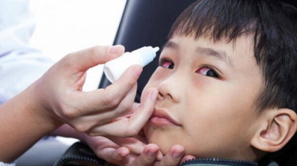 Nguyên nhân gây đau mắt đỏ