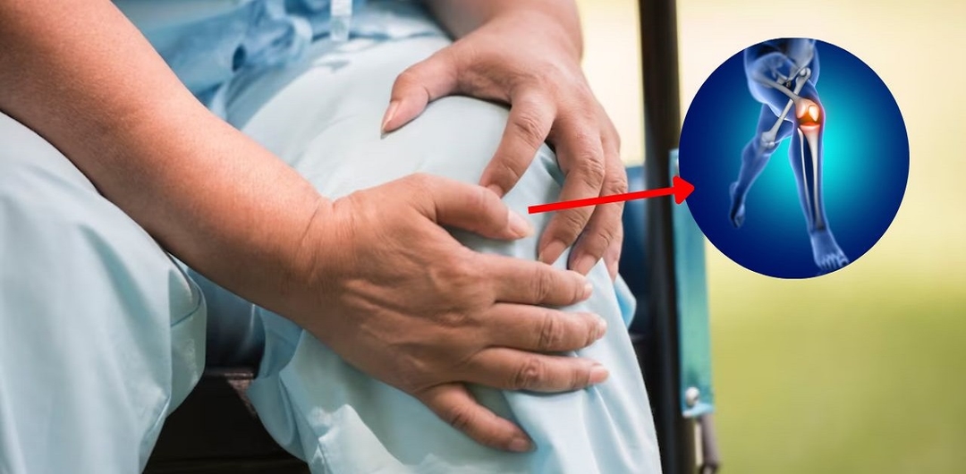 Gai thoái hóa khớp gối: Nguyên nhân và cách điều trị