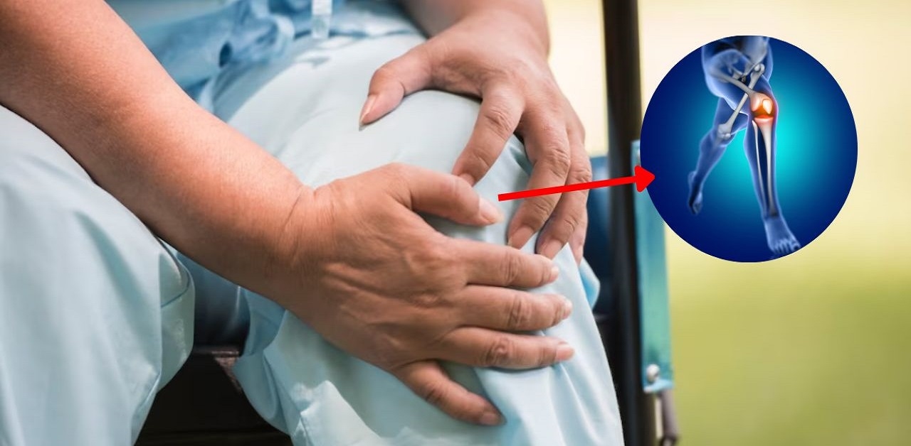 Gai thoái hóa khớp gối: Nguyên nhân và cách điều trị