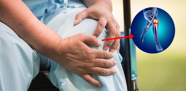 Gai thoái hóa khớp gối: Nguyên nhân và cách điều trị