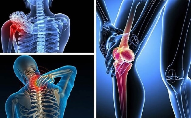 Nguyên nhân gây thoái hóa khớp gối gồm chấn thương, béo phì