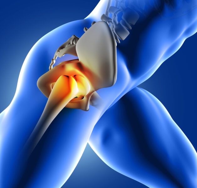Viêm khớp xương chậu là nguyên nhân phổ biến gây đau thắt lưng