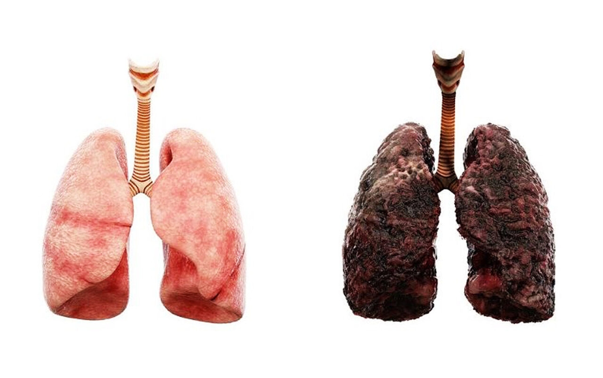 Chẩn đoán, điều trị ung thư gan nguyên phát