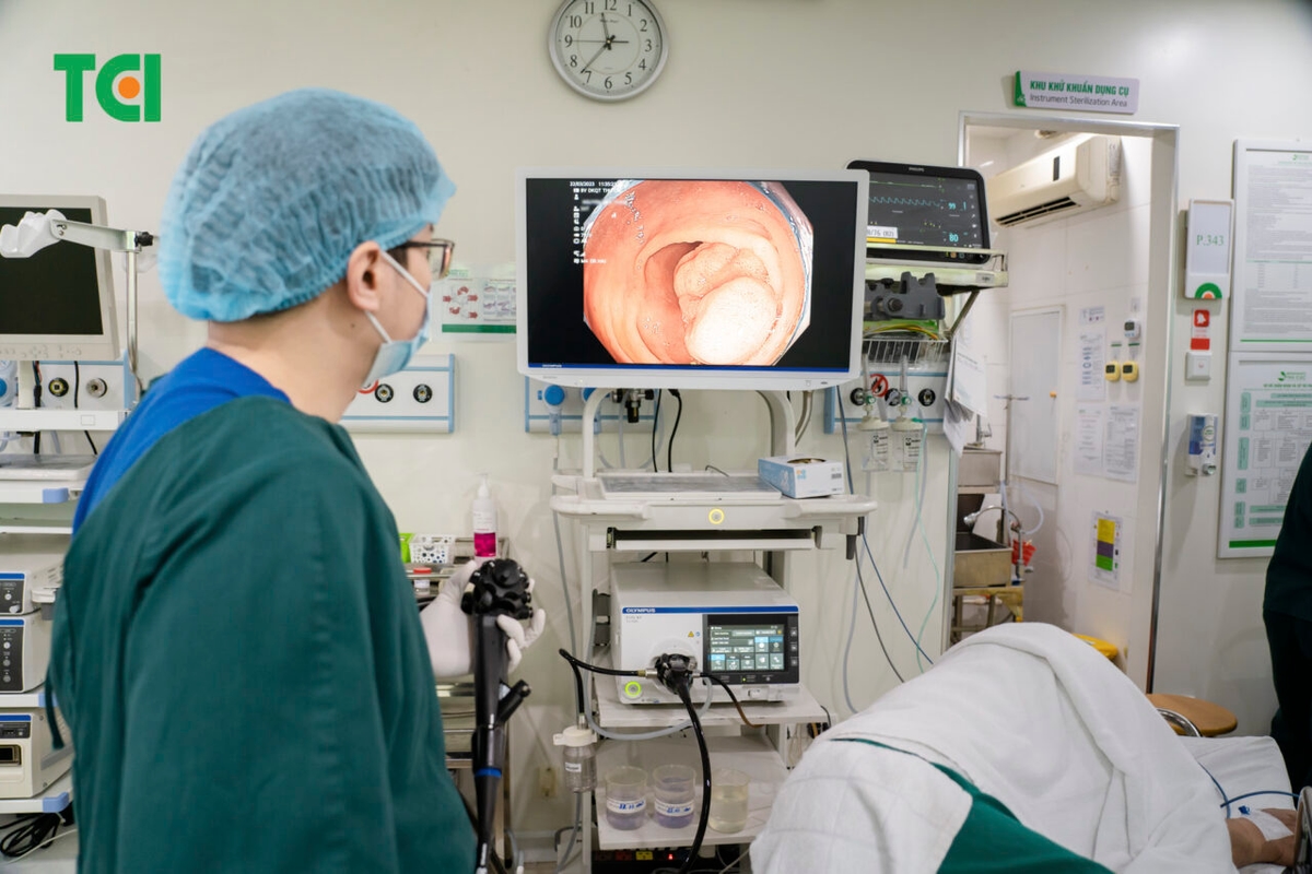 Bị polyp đại tràng khi nào phải cắt và thực hiện như thế nào?