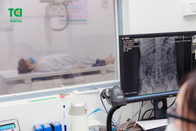 Khám ngay để nhận biết loại viêm khớp