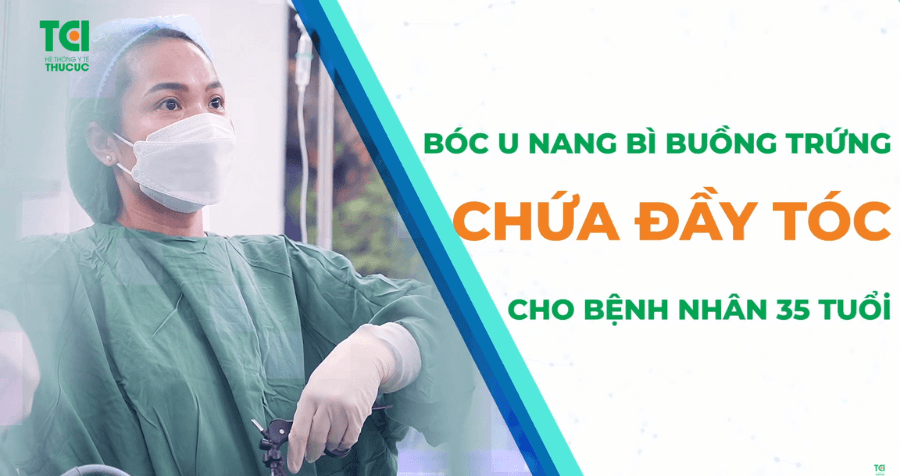 Phẫu thuật bóc u nang bì buồng trứng chứa đầy tóc cho bệnh nhân 35 tuổi