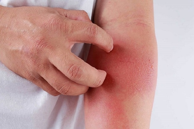 HIV là một trong những bệnh tình dục nguy hiểm