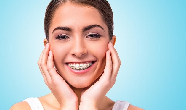 Các loại niềng răng sẽ có mức chi phí cũng như đem lại hiệu quả khác nhau