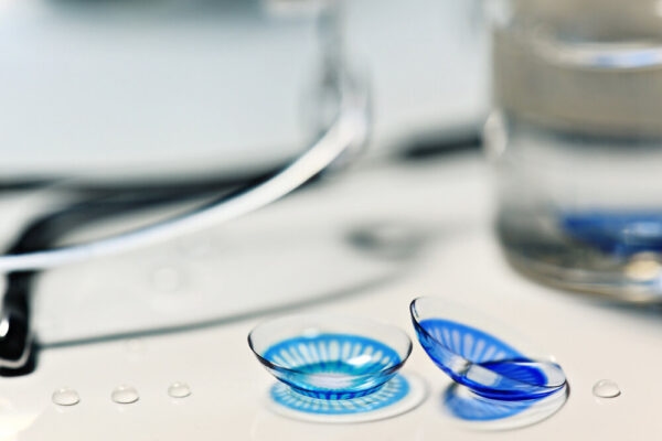 Chi phí ortho k hiện nay đắt không?