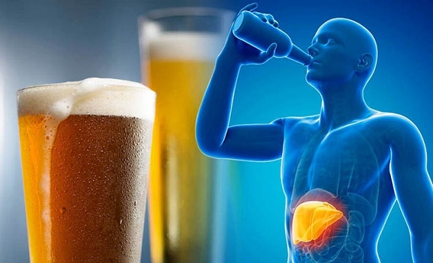 Gan nhiễm mỡ do rượu là một tình trạng mà trong gan tích tụ quá nhiều chất béo do tác động của việc tiêu thụ rượu quà đà