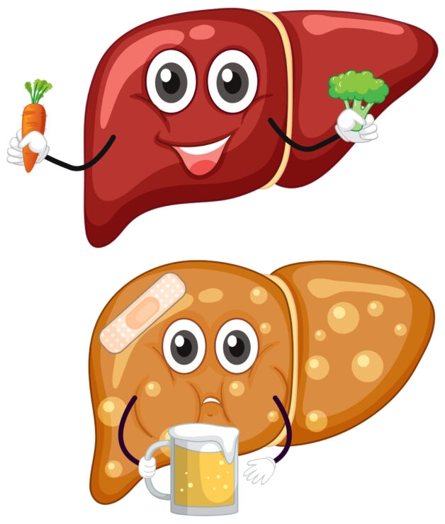 Viêm gan do rượu là tình trạng dung nạp vào cơ thể lượng lớn rượu 