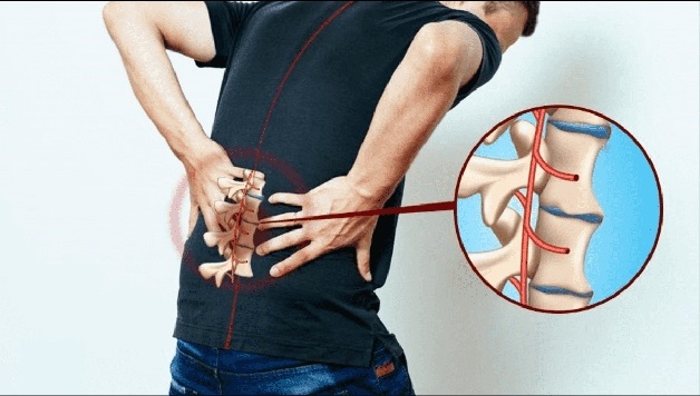 Bệnh nhân dễ bị nứt, gãy xương dù bị va chạm hoặc chấn thương nhẹ