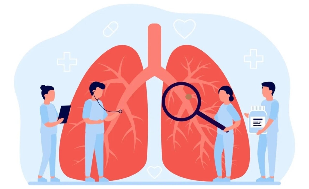 Cách chữa ung thư phổi không tế bào nhỏ theo giai đoạn