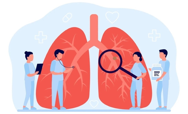 Cách chữa ung thư phổi không tế bào nhỏ theo giai đoạn