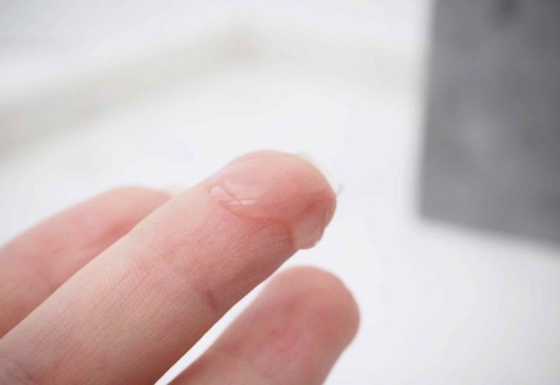 Người khỏe mạnh mắc bệnh tình dục khi có tiếp xúc với chất nhờn hoặc dịch tiết tình dục của người nhiễm bệnh