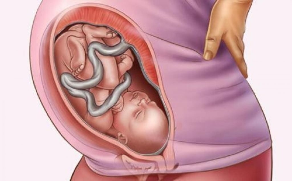Tràng hoa quấn cổ em bé, mẹ cần lưu ý điều gì?