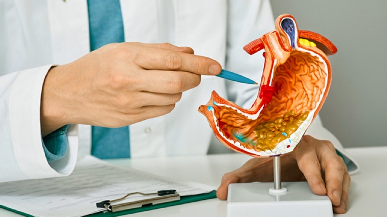 Tìm hiểu về ung thư biểu mô tuyến dạ dày