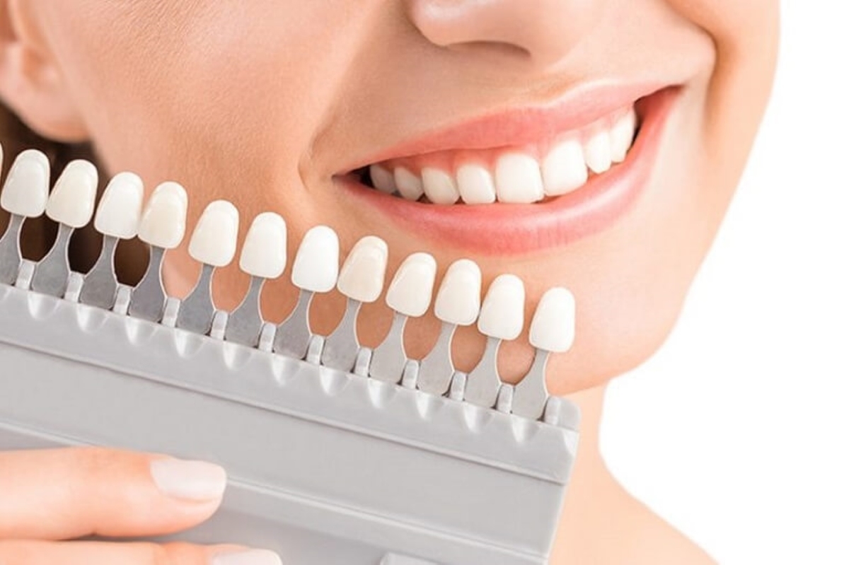 Tác hại của bọc răng sứ giá rẻ, kém chất lượng