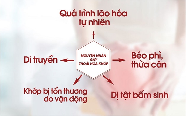 cơ chế bệnh thoái hóa khớp