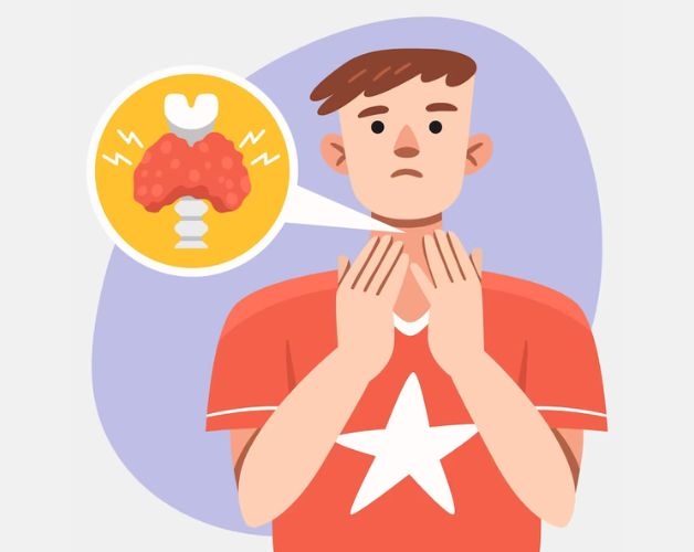 Bướu giáp đa nhân gây nhiều phiền toái cho người bệnh