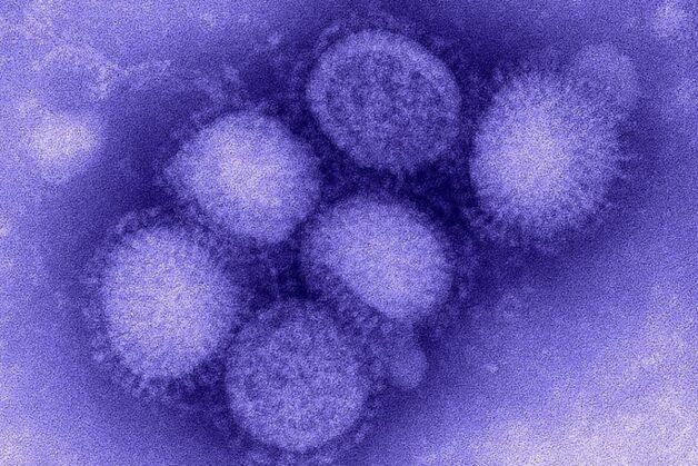 Nguyên nhân phát sinh bệnh cúm ở trẻ em là virus Cúm