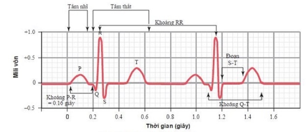 Điện tâm đồ bình thường thể hiện qua các chỉ số