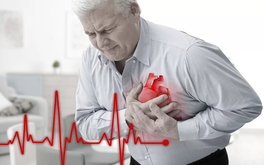 Cảnh báo sai lầm khi cấp cứu đột quỵ nguy hiểm