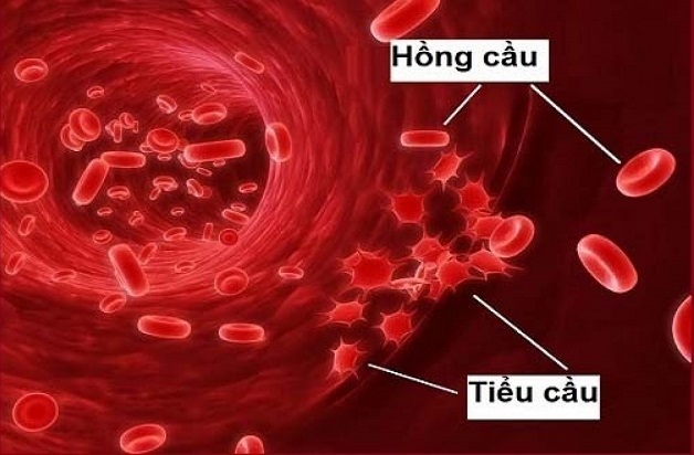Tiểu cầu là loại tế bào nhỏ nhất trong máu người. Số lượng tiểu cầu ở bệnh nhân sốt xuất huyết có thể giảm do nhiều nguyên nhân. 