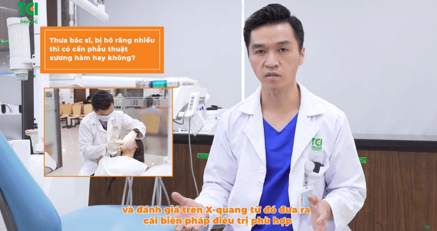 Răng hô nhiều có cần phẫu thuật để cải thiện không?