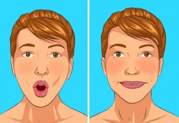 Điều trị phục hồi cho bệnh nhân bị đột quỵ méo miệng khó nói