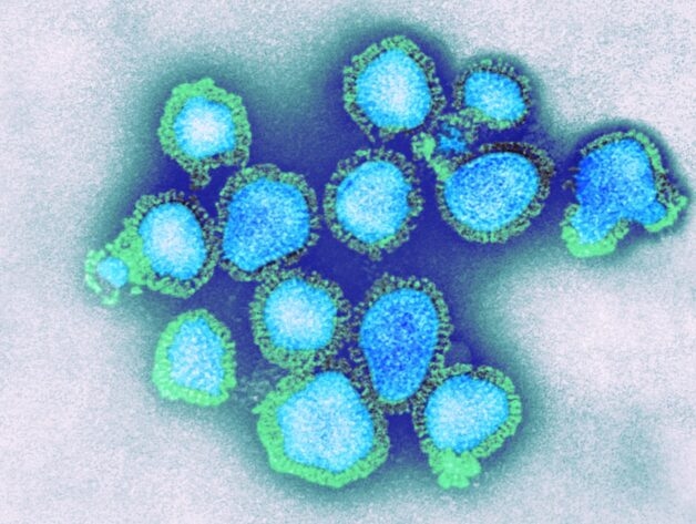 Cúm - một bệnh truyền nhiễm cấp tính đường hô hấp, có nguyên nhân phát sinh là virus Influenza.