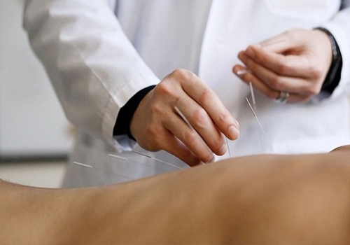 Châm cứu cho người bệnh sau đột quỵ