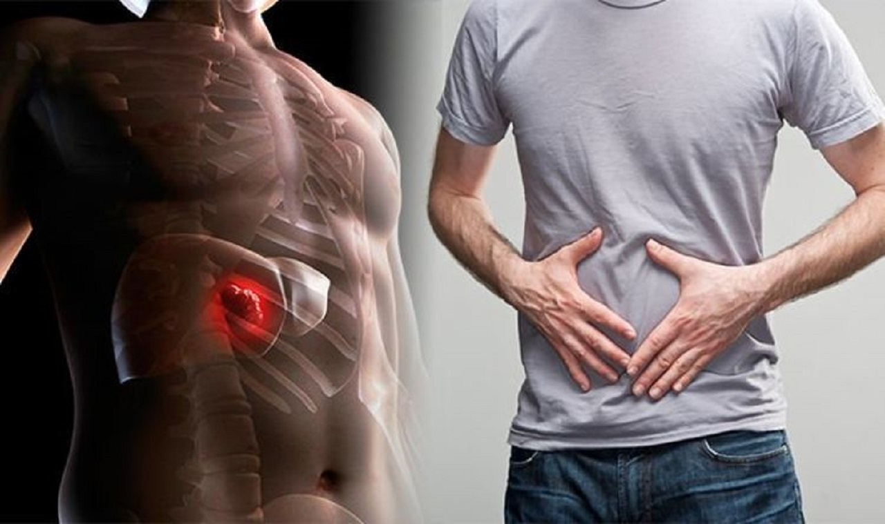 Triệu chứng K gan và cách phòng tránh ung thư gan