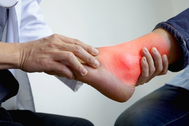 Viêm gout cấp tính và những điều cần biết