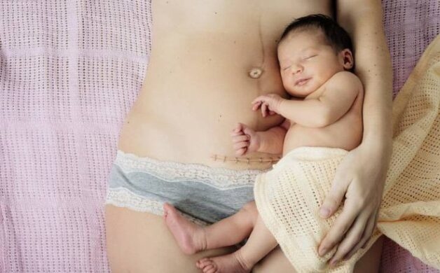 Tuyến vú có nhiều thay đổi sau sinh
