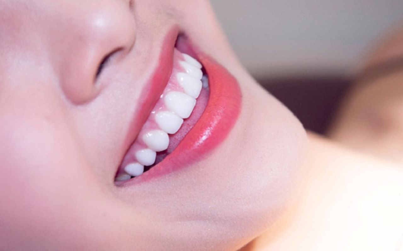 Giải đáp: Có nên bọc răng sứ zirconia và những điều cần biết