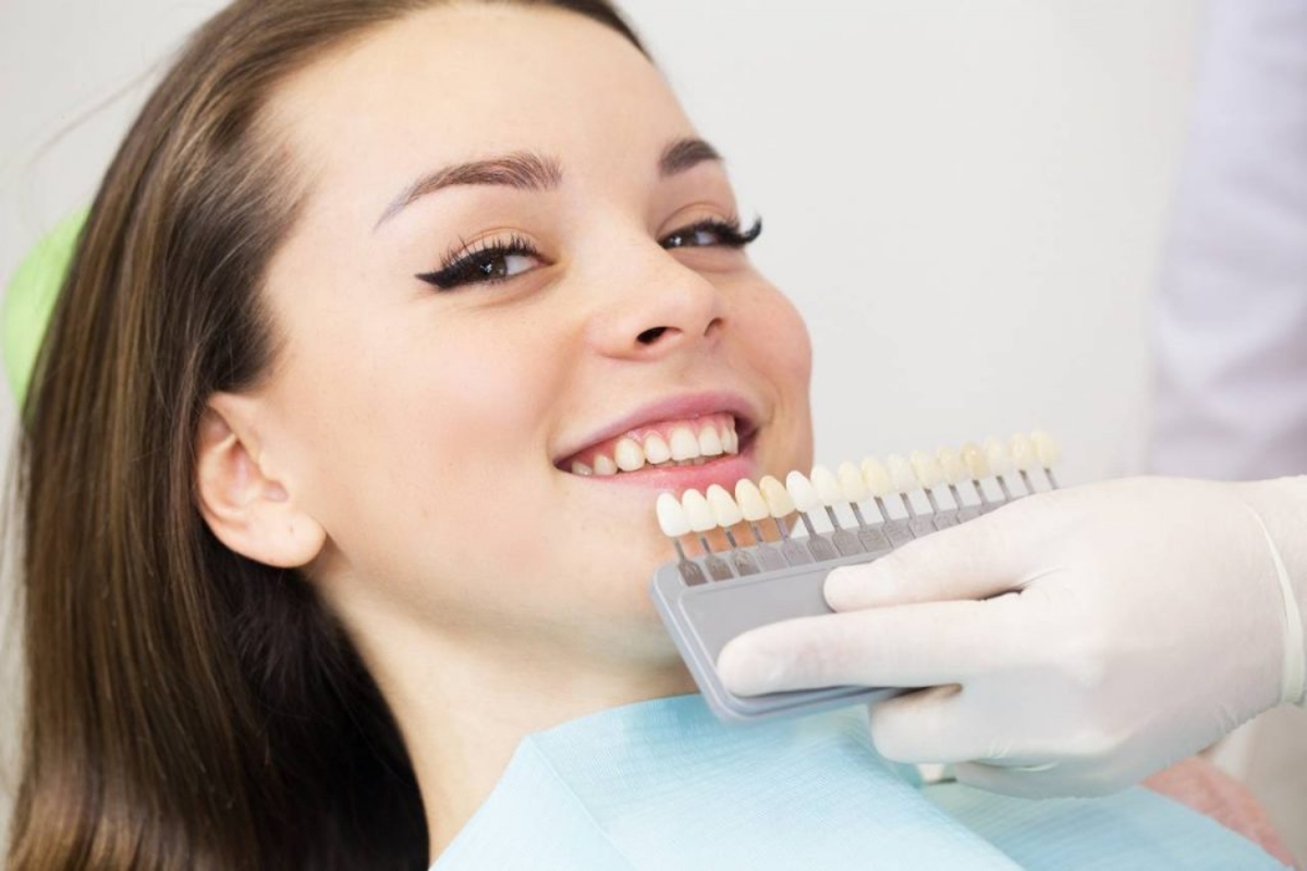 Giải đáp chi tiết: Dán sứ veneer loại nào tốt nhất?