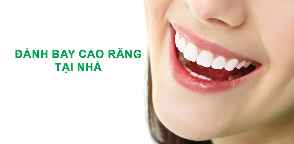 Tìm hiểu cách đánh bay cao răng tại nhà hiệu quả