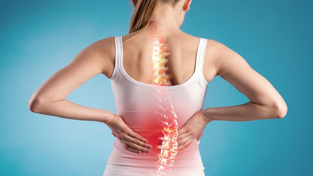 Tìm hiểu nguyên nhân, triệu chứng viêm cột sống dính khớp