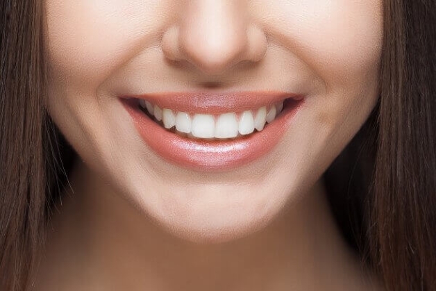 hàn răng thưa có bền không bạn có biết
