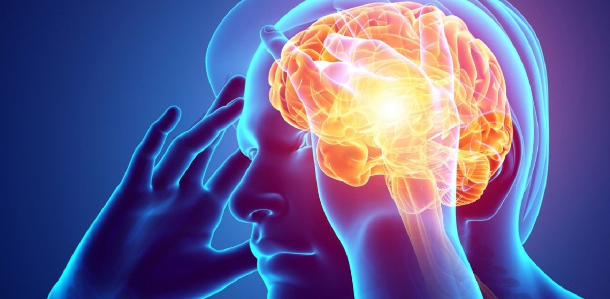Những hiểu lầm về đột quỵ cần tránh
