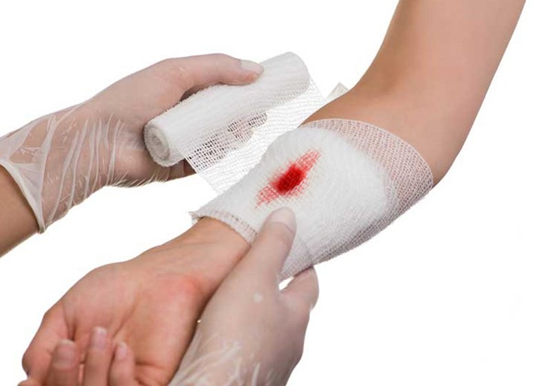 Các vết thương nhẹ hơn như trầy xước da, bị bỏng,... thì vẫn cần tiêm ngừa uốn ván để đảm bảo an toàn