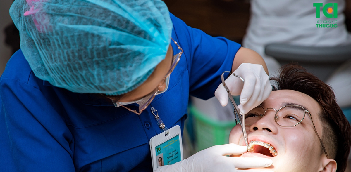 Niềng răng chỉnh nha &#8211; Những thắc mắc phổ biến nhất