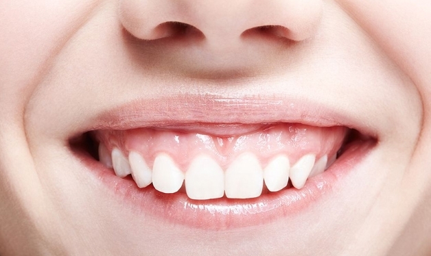 phẫu thuật cười hở lợi ở đâu tốt
