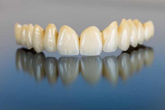 6 Loại răng sứ cao cấp được ưa chuộng hiện nay