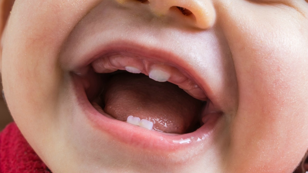 Tại sao răng chỉ mọc 2 lần và những điều cần biết về thay răng